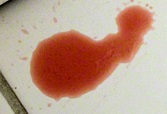 Bloed-in-de-urine-bij-een-kat