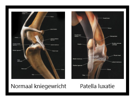 Patella-Luxatie